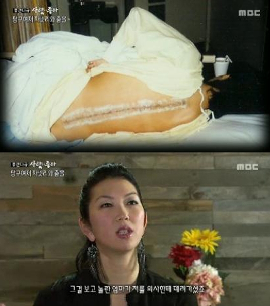 자넷리 척추 장애