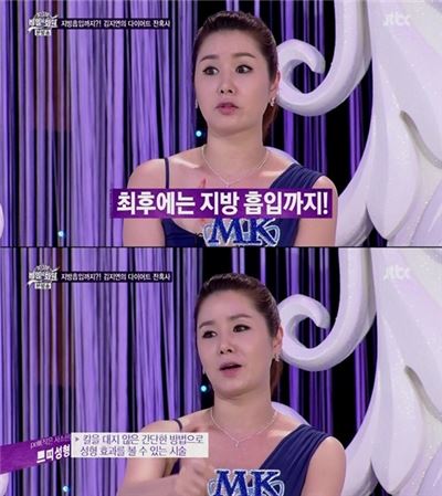 김지연 지방흡입. 사진=JTBC ‘비밀의 화원’