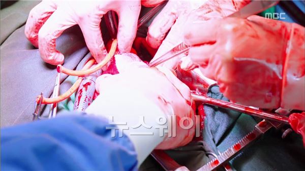 정려원, ‘메디컬 탑팀’ 리얼한 수술 장면 소화···“진짜 수술인가?” 기사의 사진