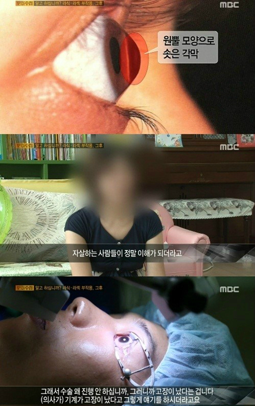 PD수첩, 라식 라섹 수술의 심각한 부작용. 사진=MBC ‘PD수첩’