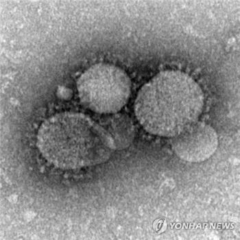 국내로 유입된 중동호흡기증후군(메르스) 바이러스가 사우디아라비아 등 중동 지역에서 유행한 바이러스와 유전자 염기 서열이 거의 일치하는 것으로 확인됐다. 사진=연합뉴스 제공