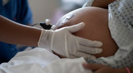 10월부터 임신부 초음파 검사 비용 줄어들어···‘6~7회 급여화’