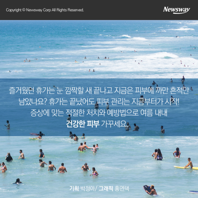  ‘뜨거운 휴가의 흔적’ 일광화상···피부과 가야할까? 기사의 사진