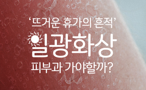  ‘뜨거운 휴가의 흔적’ 일광화상···피부과 가야할까?