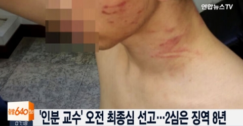대법원, 제자에 가혹행위한 ‘인분 교수’ 징역 8년 확정