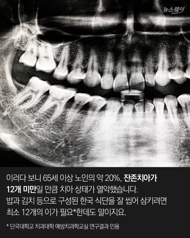 치과 못 가는 대한민국 노인들 기사의 사진