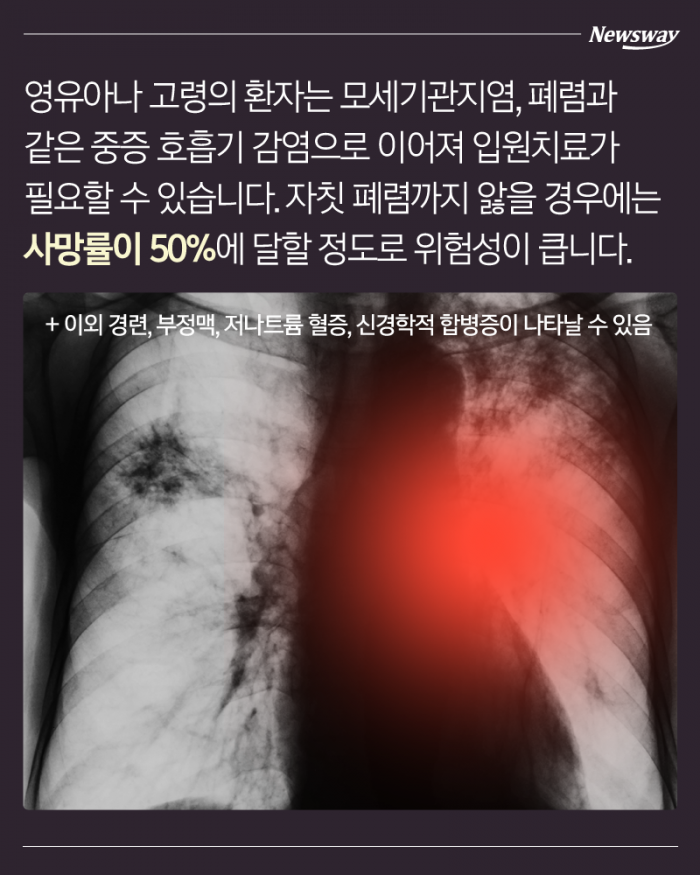 감기·독감 말고 또? 내 아이를 위협하는 겨울 유행병 기사의 사진