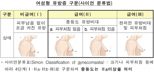 여성형 유방증 구분. 자료=금융감독원