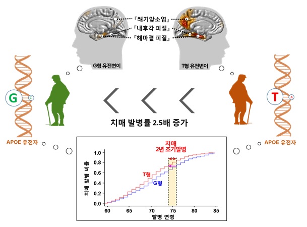 조선대 치매국책연구단,  치매 예측 정확도 개선 새로운 유전자검사법 개발 기사의 사진