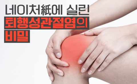 네이처紙에 실렸다는 퇴행성관절염의 비밀