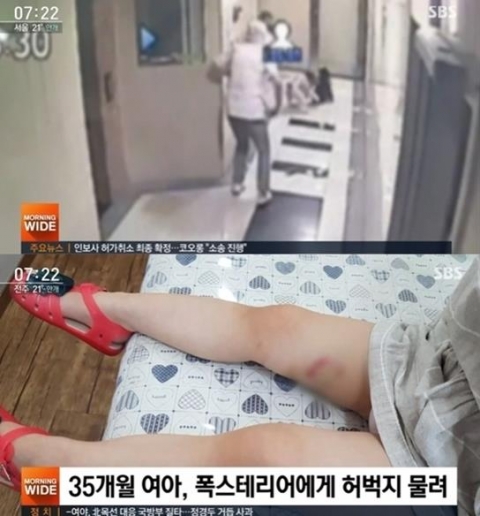 아파트서 세 살 여아 폭스테리어에 물려···‘입마개 착용’ 약속했지만 안지킨 견주