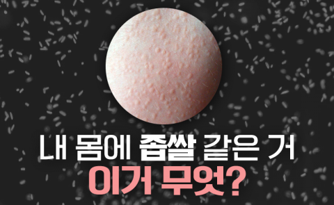 내 몸에 좁쌀 같은 거 이거 무엇?