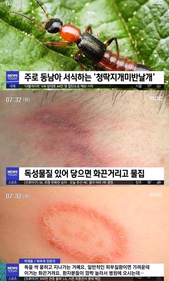 ‘화상벌레’ 공포 확산···기숙사 이어 다른 지역에서도 목격담 이어져