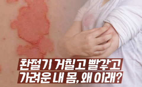환절기 거칠고 빨갛고 가려운 내 몸, 왜 이래?