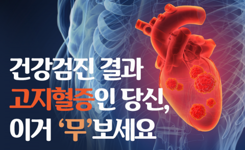 건강검진 결과 고지혈증인 당신, 이거 ‘무’보세요