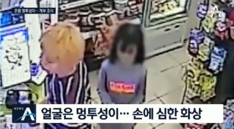 ‘창녕 아동학대’ 계부, 프라이팬에 손 지져···‘조현병’ 친모도 가담
