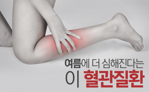 여름에 더 심해진다는 이 혈관질환