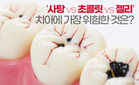 ‘사탕 vs 초콜릿 vs 젤리’ 치아에 가장 위험한 것은?