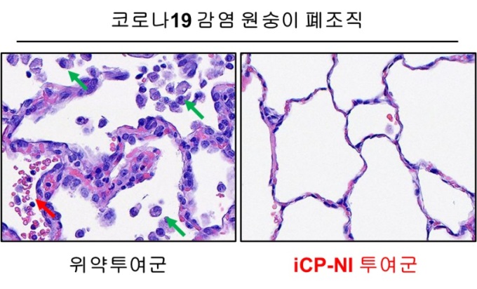 위약투여군에서 면역세포 침윤(녹색 화살표)과 출혈(붉은색 화살표)이 보이는 것과 달리, iCP-NI 투여군에서는 조직파괴가 발견되지 않았다/사진=셀리버리