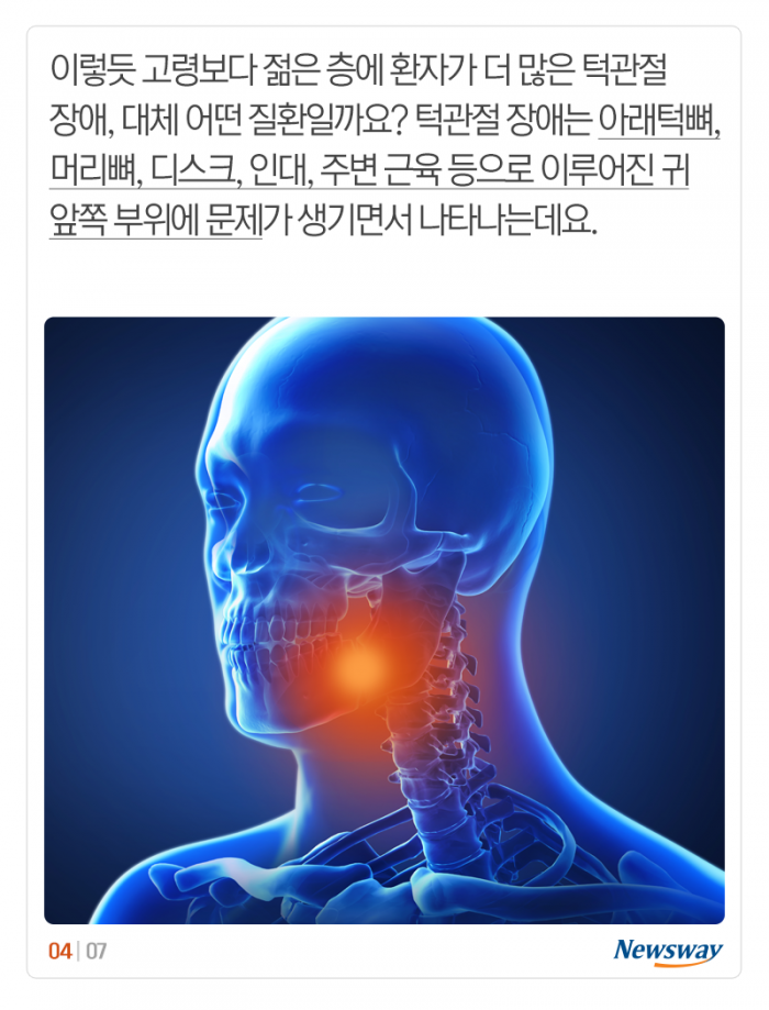 철근도 씹어 먹을 나이? “20대 턱 조심하세요” 기사의 사진