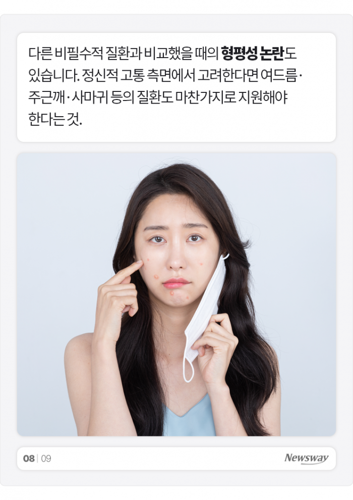 청년 탈모 지원 나선 서울 성동구···"그럼 여드름은요?" 기사의 사진