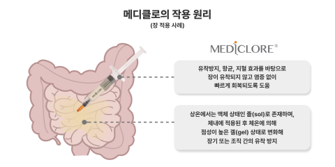 시지바이오 '메디클로' 대만·브라질 수출 계약···글로벌 시장 공략