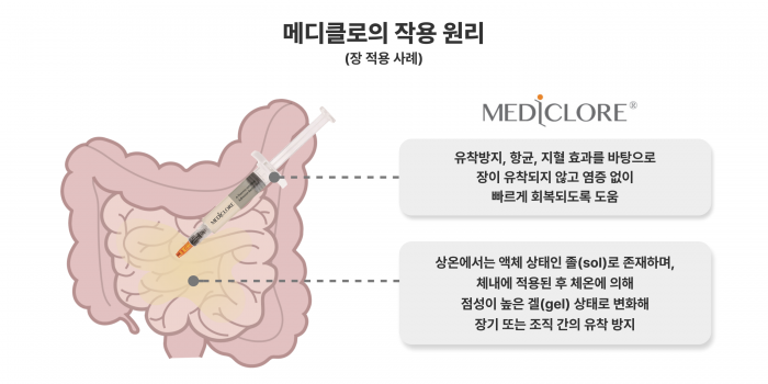 시지바이오 '메디클로' 대만·브라질 수출 계약···글로벌 시장 공략 기사의 사진