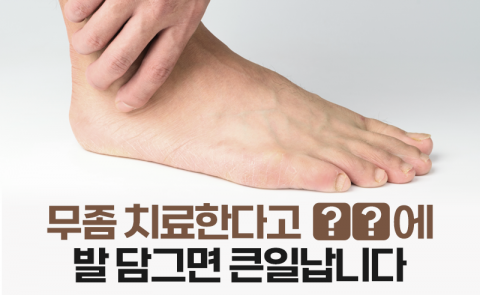 무좀 치료한다고 ○○에 발 담그면 큰일납니다