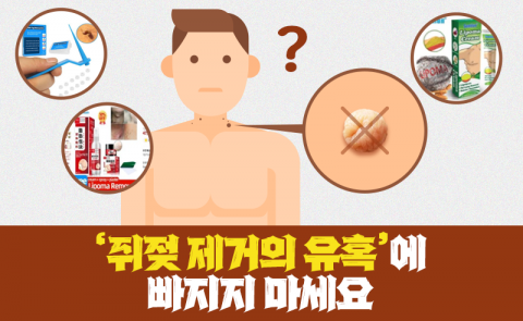 '쥐젖 제거의 유혹'에 빠지지 마세요