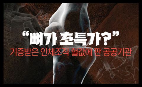"뼈가 초특가?" 기증받은 인체조직 헐값에 판 공공기관
