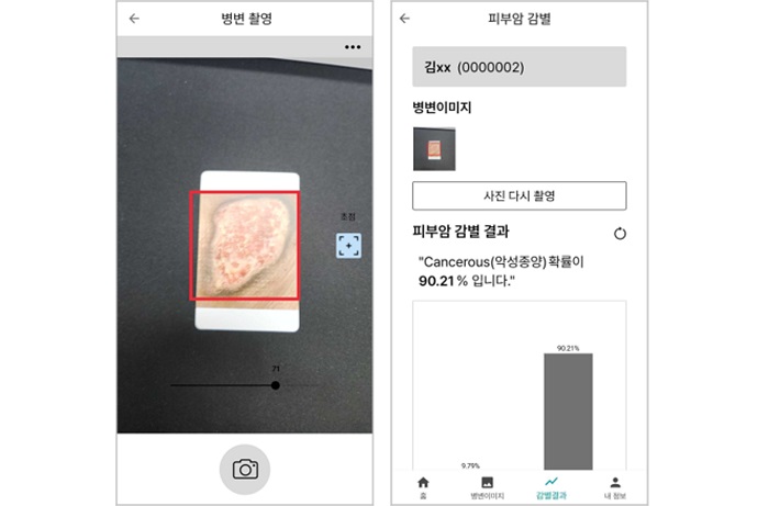라이프시맨틱스는 닥터앤서 2.0 국책과제를 통해 개발한 '피부암 영상검출·진단보조 소프트웨어(SW)'의 확증 임상시험 계획을 승인받았다. 사진=라이프시맨틱스 제공