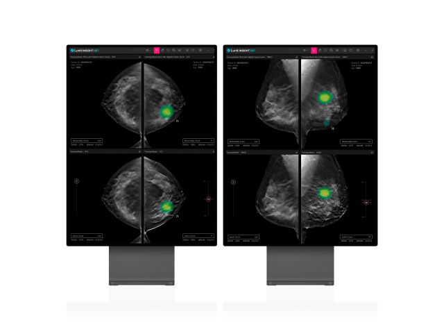 루닛 3D 유방암 검진 솔루션 FDA 허가···"美 중심 성장 이어갈 것"