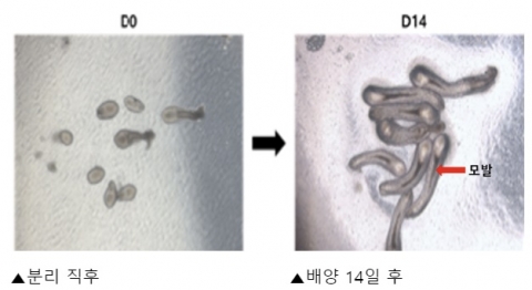 강스템바이오, 인간 모낭 오가노이드 기반 탈모치료제 사업화 나서