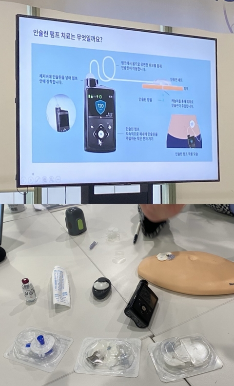 '1형 당뇨' 치료 환경 바꾼 인공췌장 ···한국선 접근성 ↓