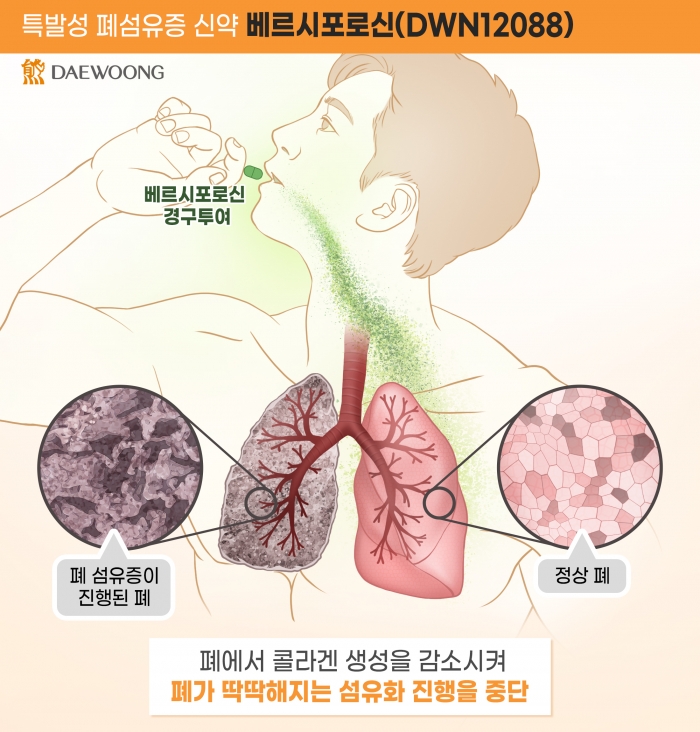 베르시포로신(DWN12088) 작용 기전. 대웅제약 제공