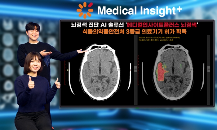 SK C&C 뇌경색진단 AI 솔루션 '메디컬인사이트플러스 뇌경색'이 식품의약품안전처로부터 3등급 의료기기 허가를 받았다. 사진=SK C&C 제공