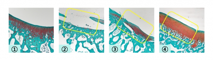 (왼쪽부터) 정상 대퇴골, 연골 결손 대퇴골, 연골 결손 대퇴골에 TGF-β3 미포함 히알루론산 겔을 적용한 후 12주 시점, 연골 결손 대퇴골에 미세천공술을 적용하고 TGF-β3 포함 히알루론산 겔을 적용한 후 12주 시점의 사진. 시지바이오 제공