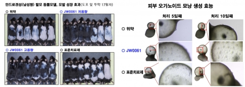 JW중외 'JW0061' 기존 탈모치료제 대비 '모낭생성·모발성장' 우위성 입증