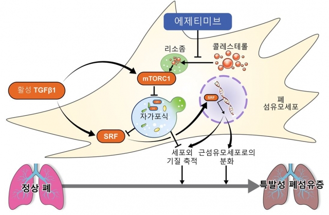 특발성 폐섬유증, '항콜레스테롤제' 복용시 사망 위험 최대 62% ↓