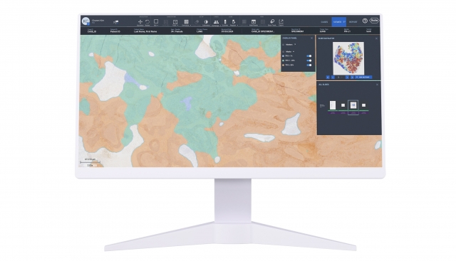 루닛·로슈진단, 디지털 병리 플랫폼 '네비파이'에 AI 솔루션 통합