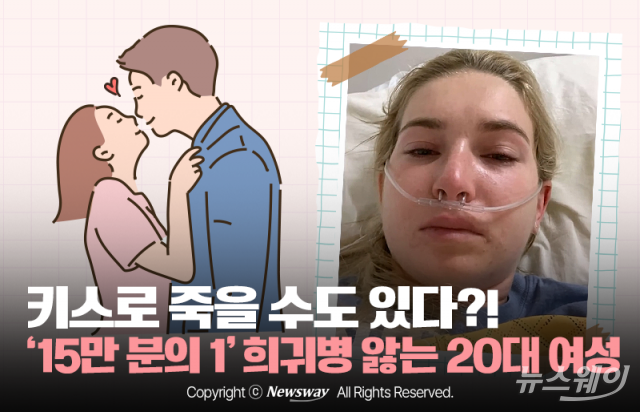 키스로 죽을 수도 있다?! '15만 분의 1' 희귀병 앓는 20대 여성