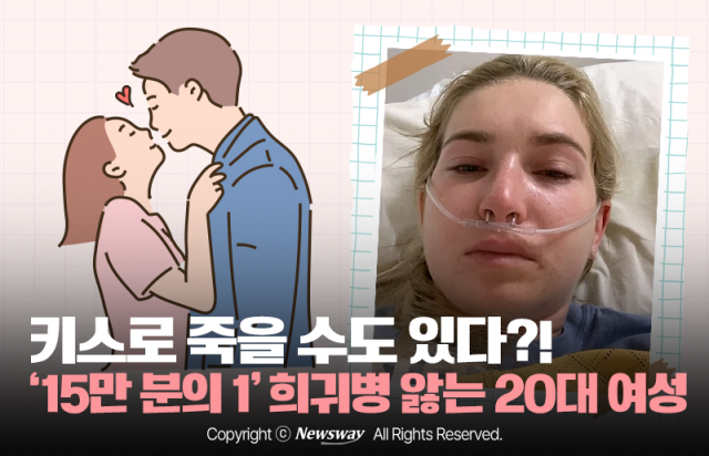 키스로 죽을 수도 있다?! '15만 분의 1' 희귀병 앓는 20대 여성