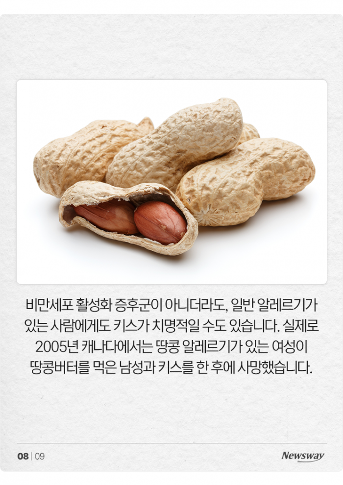 키스로 죽을 수도 있다?! '15만 분의 1' 희귀병 앓는 20대 여성 기사의 사진