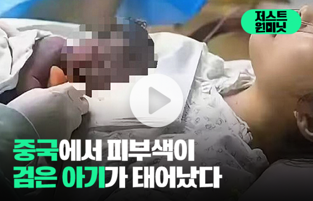 중국에서 피부색이 검은 아기가 태어났다