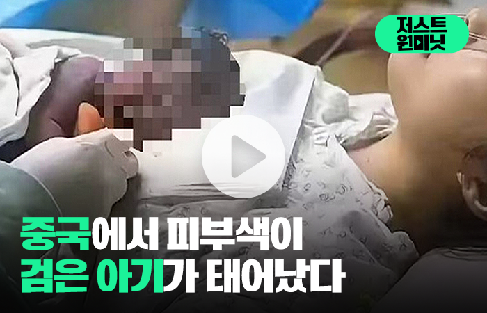 중국에서 피부색이 검은 아기가 태어났다 기사의 사진