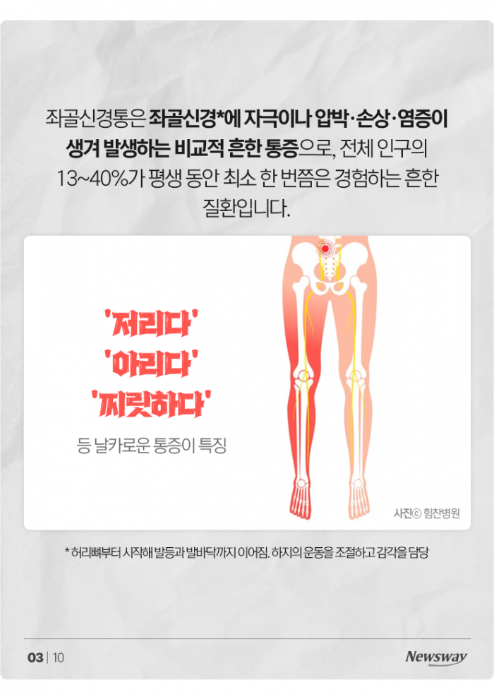 다리 꼬고 앉는 습관, 요즘 날씨에 '이 질환' 부른다 기사의 사진