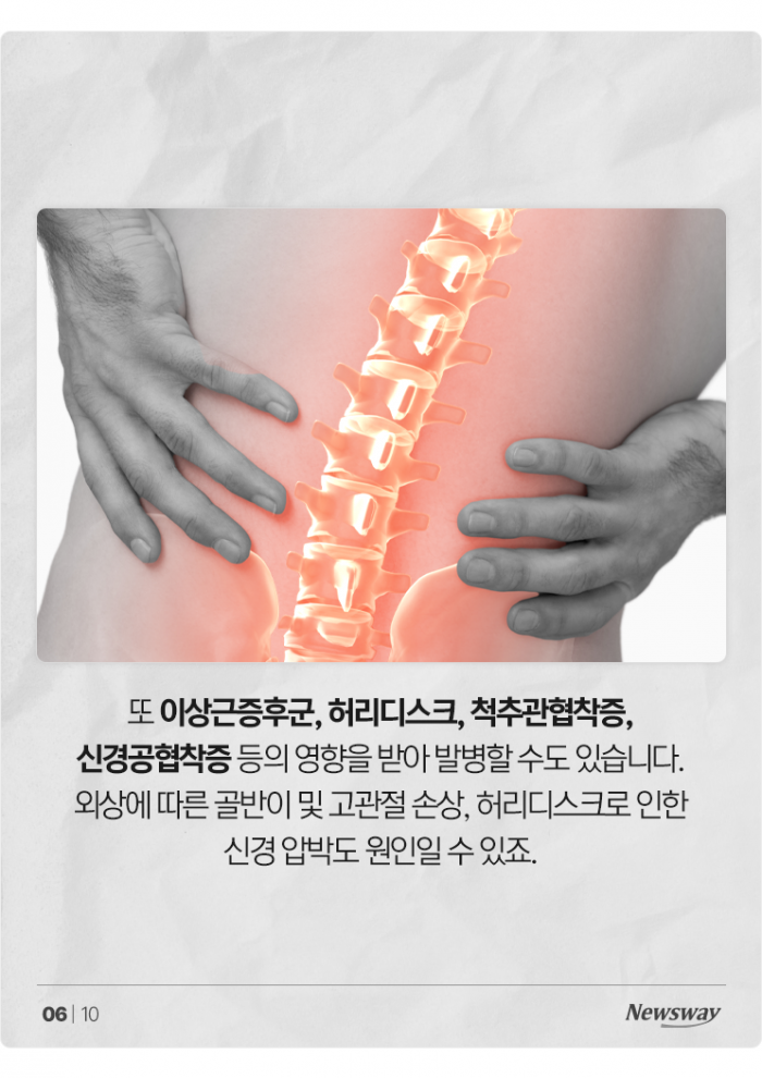 다리 꼬고 앉는 습관, 요즘 날씨에 '이 질환' 부른다 기사의 사진