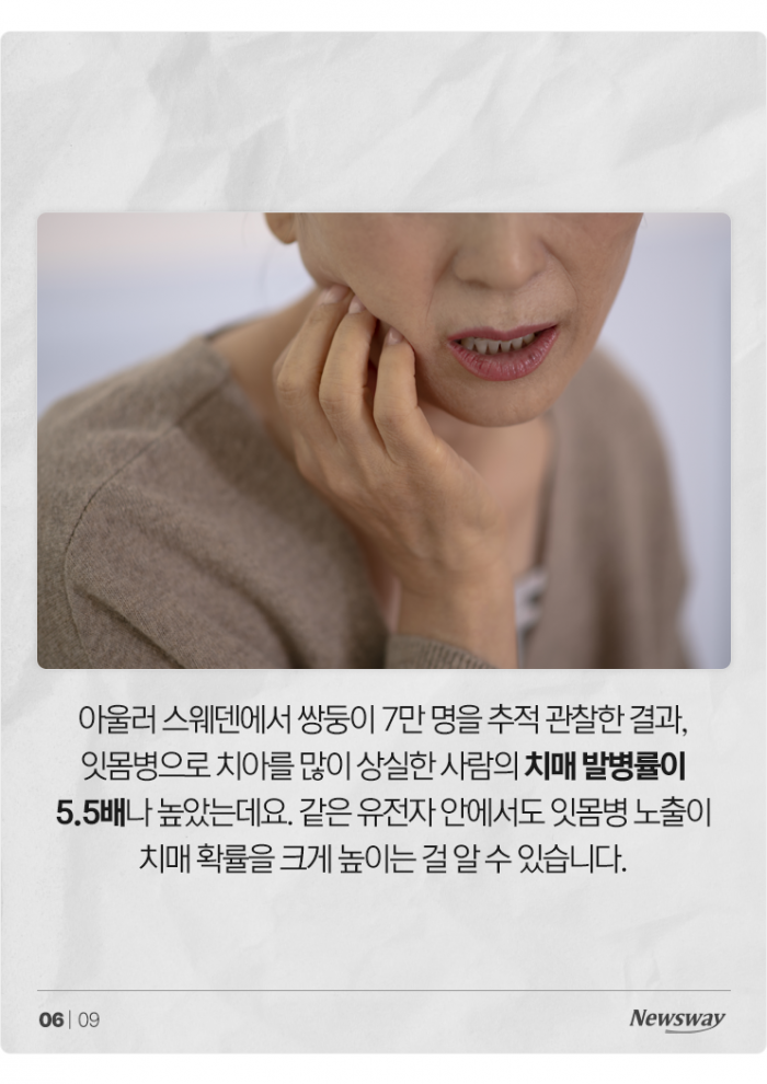 치매 부르는 박테리아, 알고 보니 우리 '○○'에 살고 있었다 기사의 사진