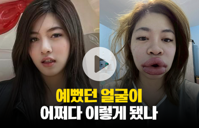 예뻤던 얼굴이 어쩌다 이렇게 됐나