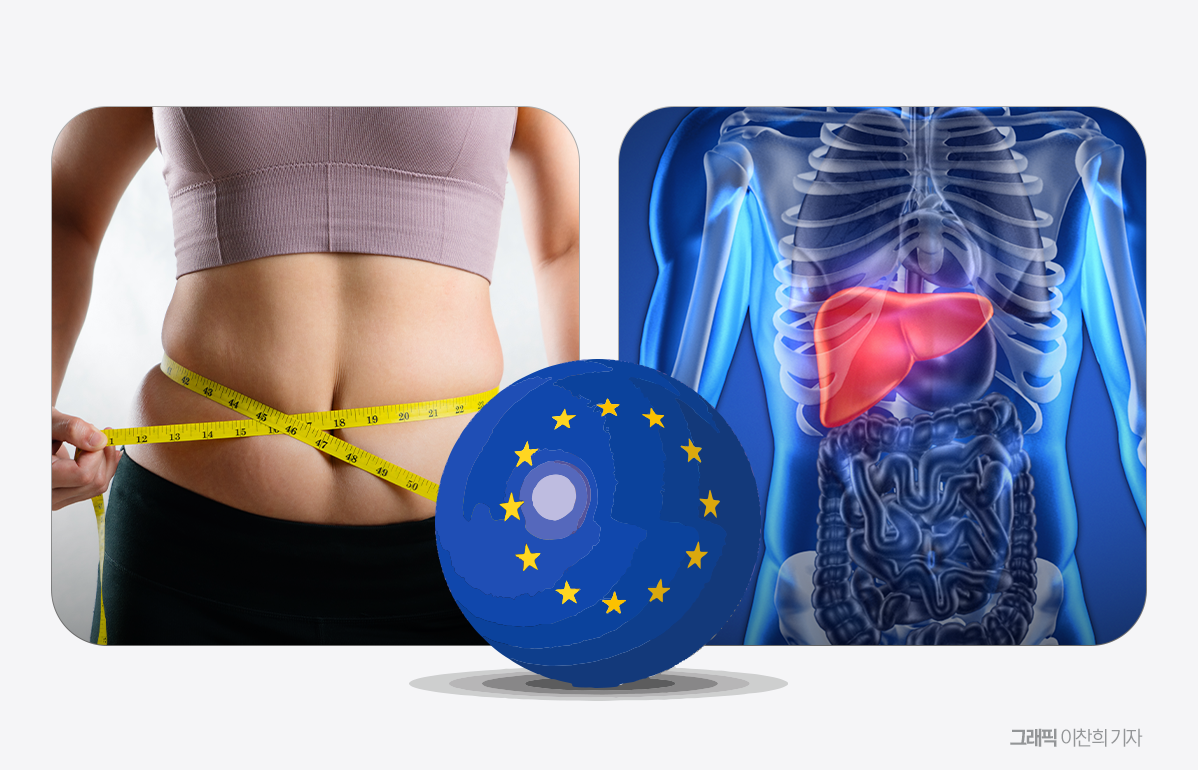 대사이상 지방간염 첫 신약 EU 승인 임박...국내사는 - 뉴스 썸네일 이미지
